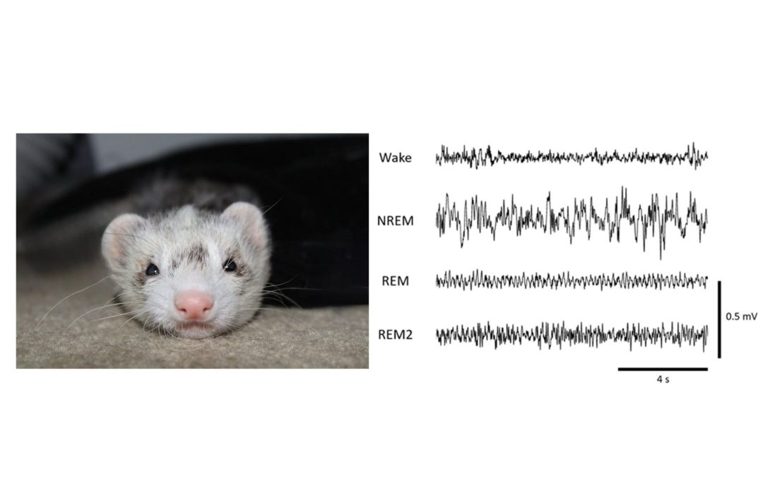 Your Sleep Might Hold the Secret to Stopping Constant Ear Ringing