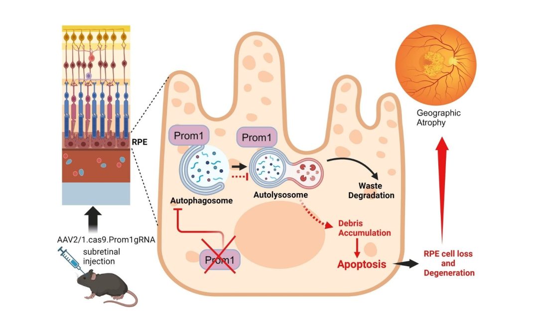 This Tiny Cell Change Could Be Behind Millions of Vision Problems