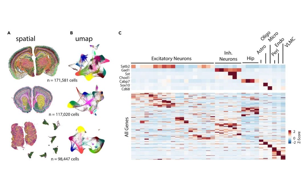 Gene expression in brain cells studies with high resolution