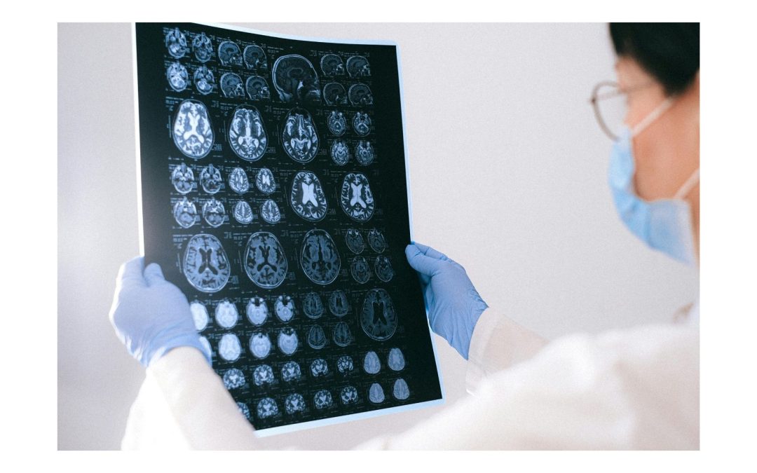 The keto diet may help prevent memory-related diseases